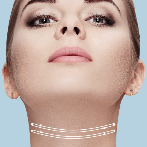 Neck (Platysmal) Bands - Perfect Skin Solutions