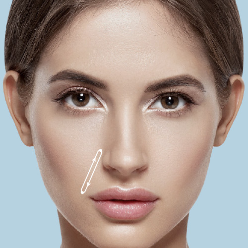 Nasolabial Lines Perfect Skin Solutions