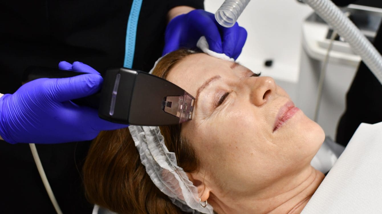 patient receiving morpheus8 treatment