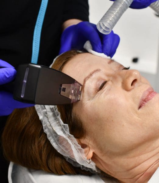 Morpheus8 Recovery Time: What to Expect