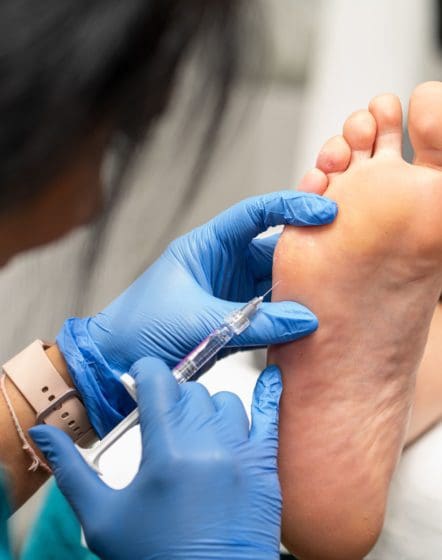 applying foot fillers