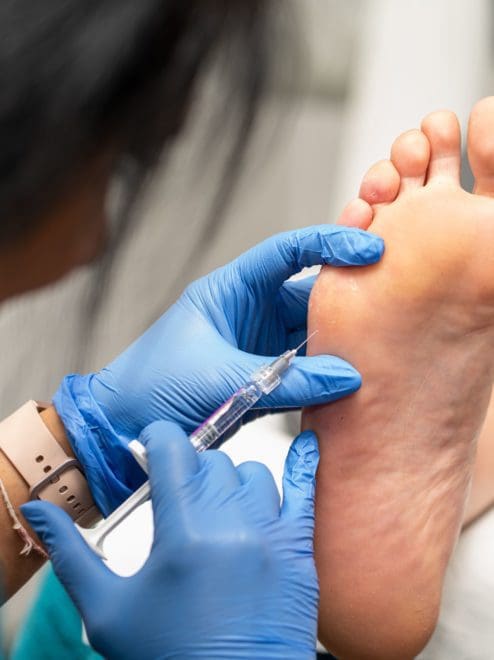 applying foot fillers