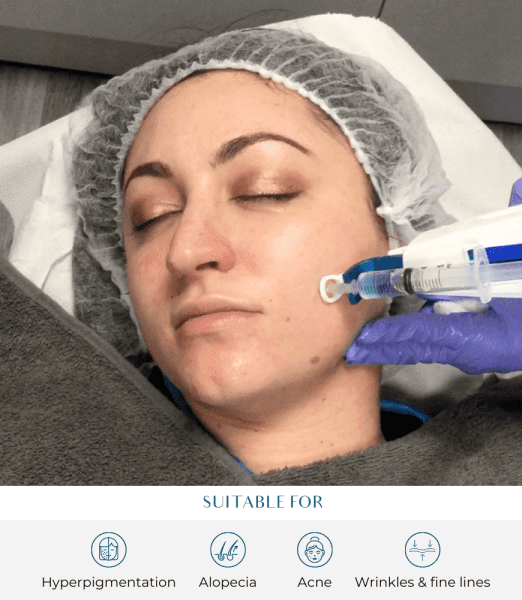 Mesotherapy Hair Cost: What to Expect at Perfect Skin Solutions