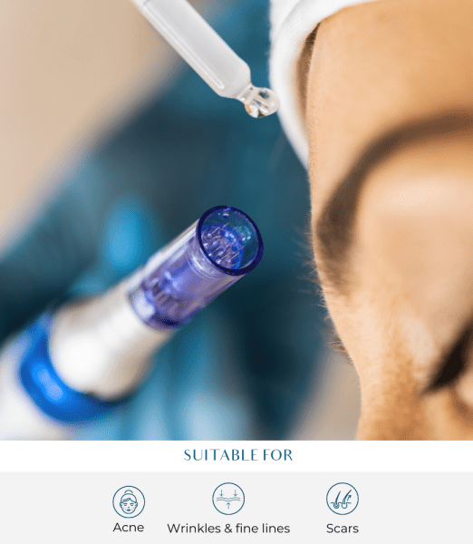 Mother’s Day Competition: Win Microneedling Treatments for You and Your Mum!