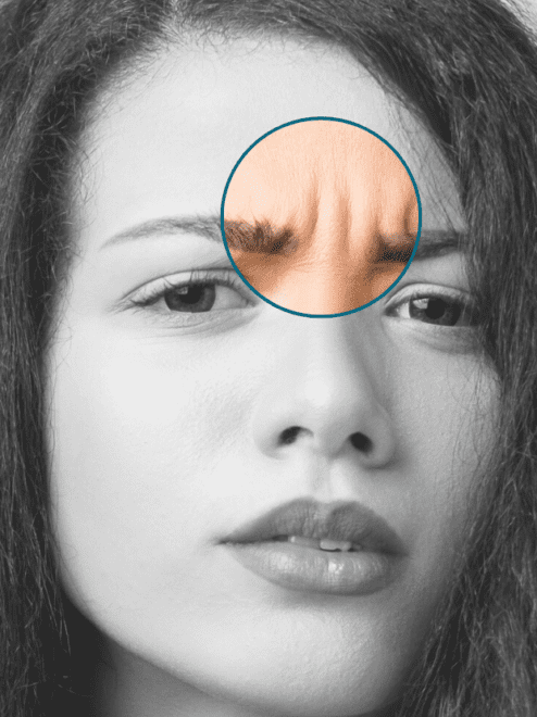 frown lines highlighted on a model