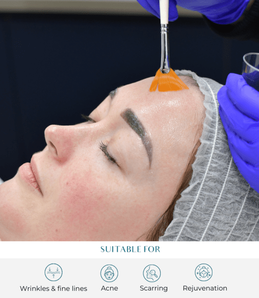 The Complete Guide to Healthier, Radiant Skin with Medical Facial