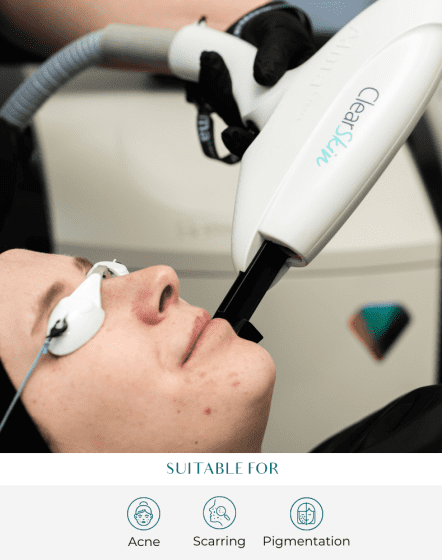 patient being treated with clearskin machine