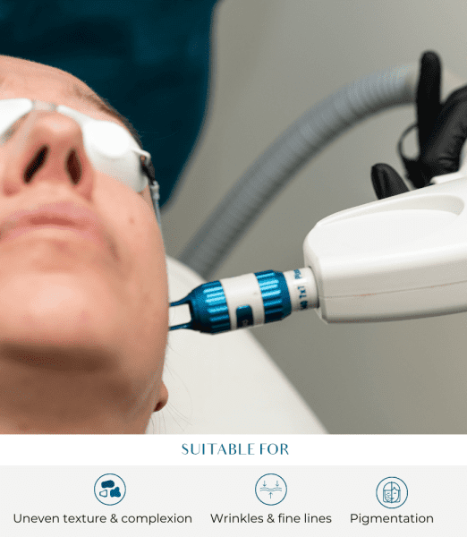 Everything You Need to Know About Laser Treatments for the Face