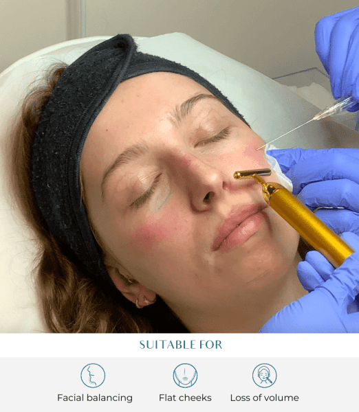 Cheek & Nasolabial Fold Fillers