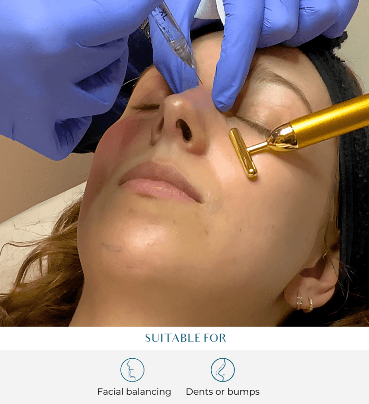 nose filler treatment at perfect skin solutions