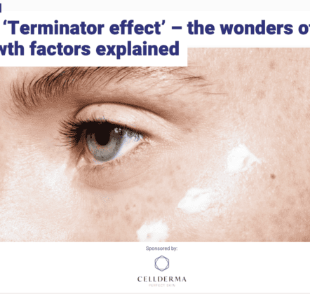 The ‘Terminator effect’ – the wonders of growth factors explained