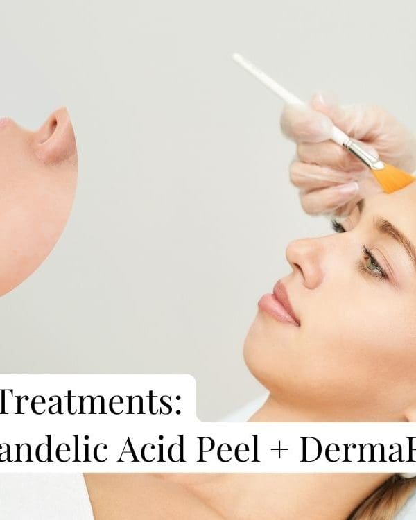 Combination Treatments: Chapter 1 – Mandelic Acid Peel + DermaFNS  