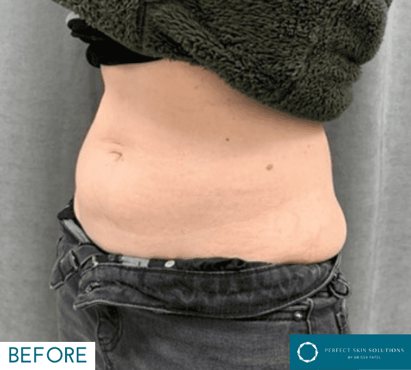 weight loss treatment before