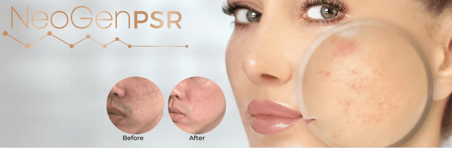 Botox from £145 | Skin & Foot Treatment | Skin Specialist | Dermal ...
