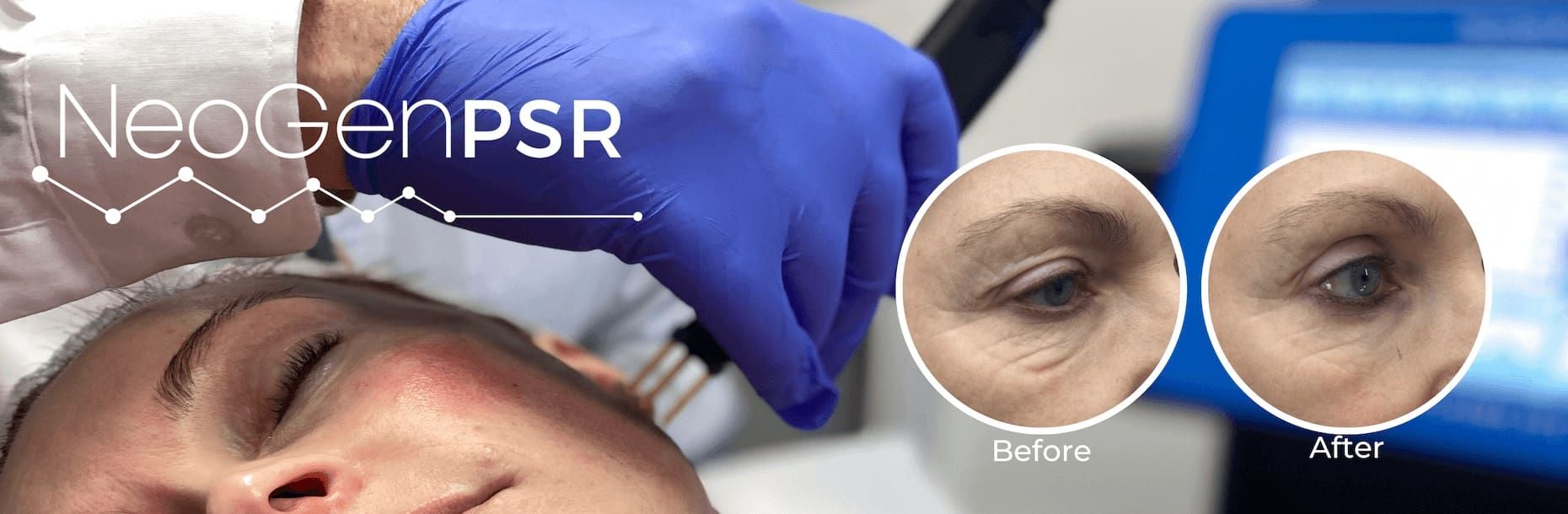 neogen treatment banner