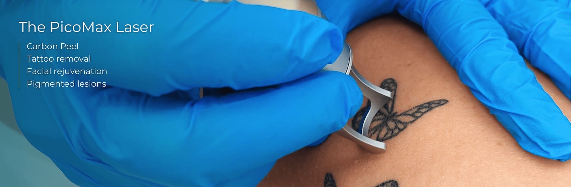 picomax tattoo removal banner
