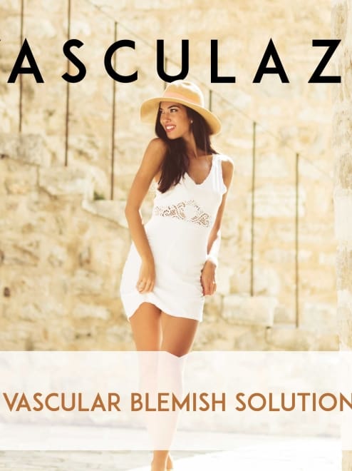 Vasculaze treatment for vein removal