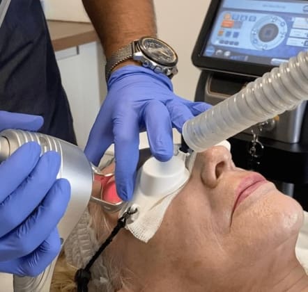 Types of Laser Treatments for Face