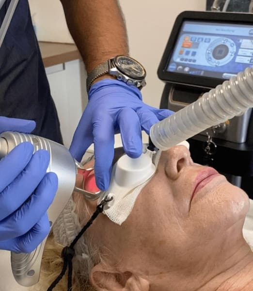 Types of Laser Treatments for Face