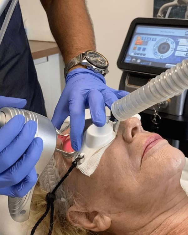 Types of Laser Treatments for Face