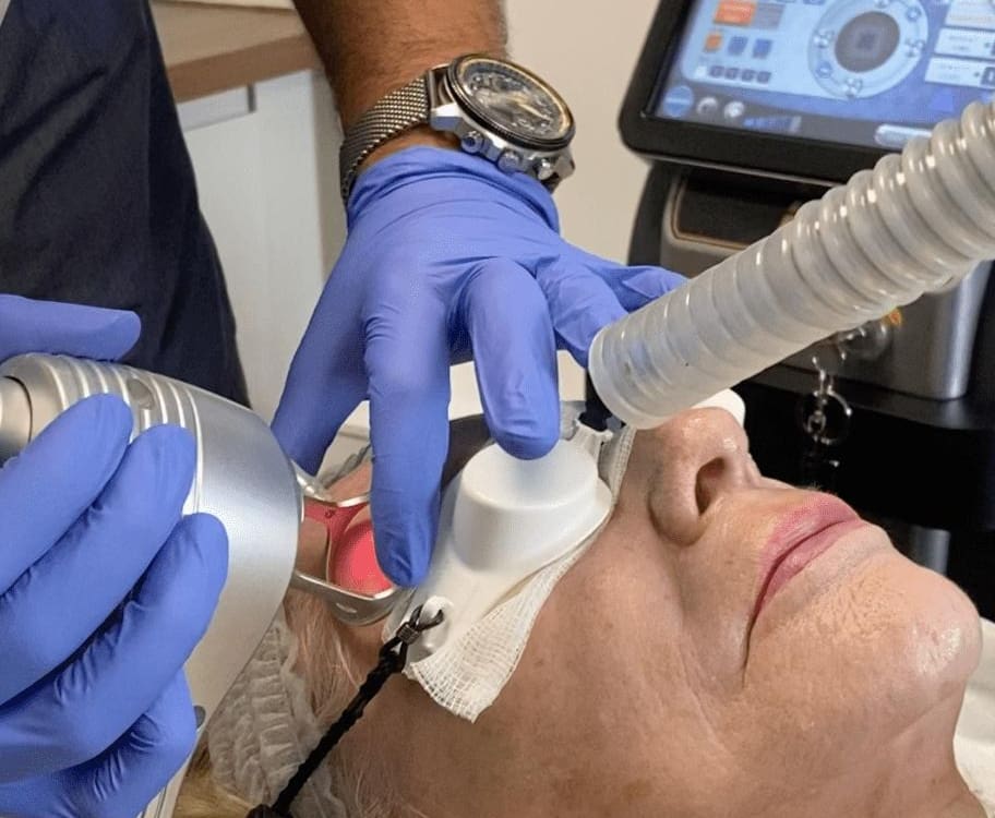 laser facial treatment