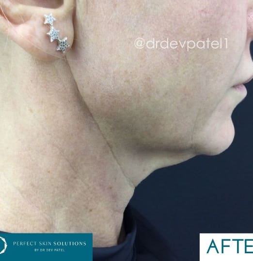 Best Care for Aging Skin: Expert Tips from Perfect Skin Solutions