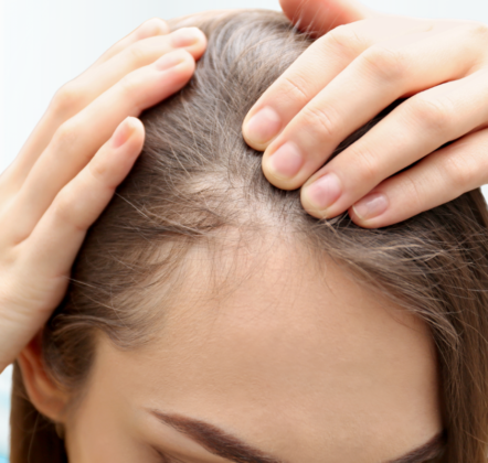 Concerned About Hair Thinning or Hair Loss?