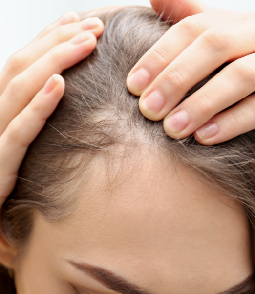 Concerned About Hair Thinning or Hair Loss?