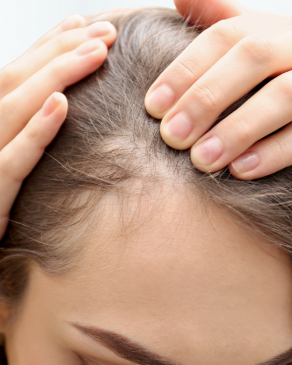 Concerned About Hair Thinning or Hair Loss?